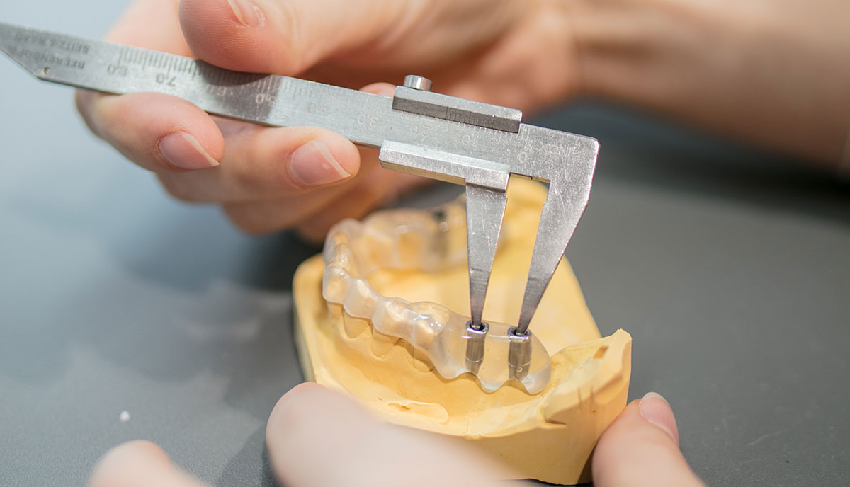 Zahnarzt überprüft den Abstand von Zahnimplantaten für die Behandlung einer craniomandibulären Dysfunktion in Herzogenrath.