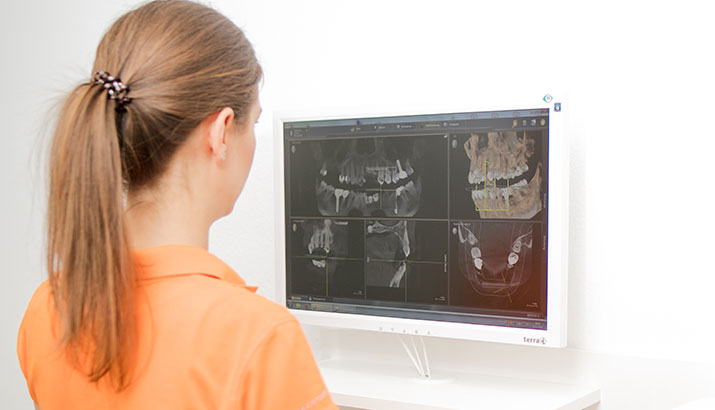 Zahnärztin schaut sich ein Röntgenbild an, um die geeignete Behandlung aus der ganzheitlichen Zahnmedizin für den Patienten zu finden.